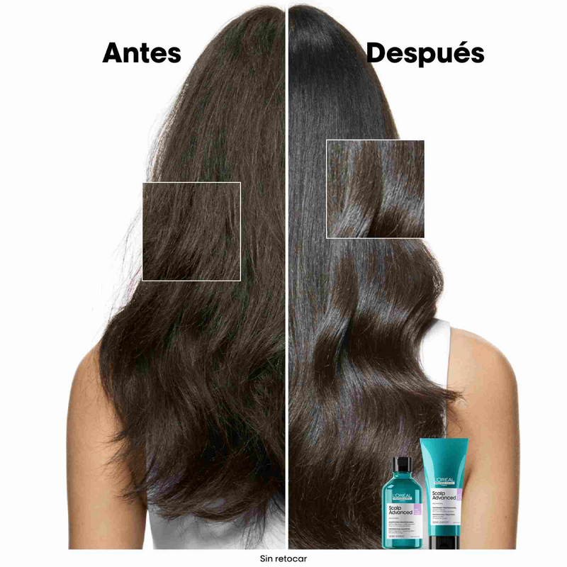 Shampoo Scalp Advanced Anti-Discomfort  Loreal x 300mL