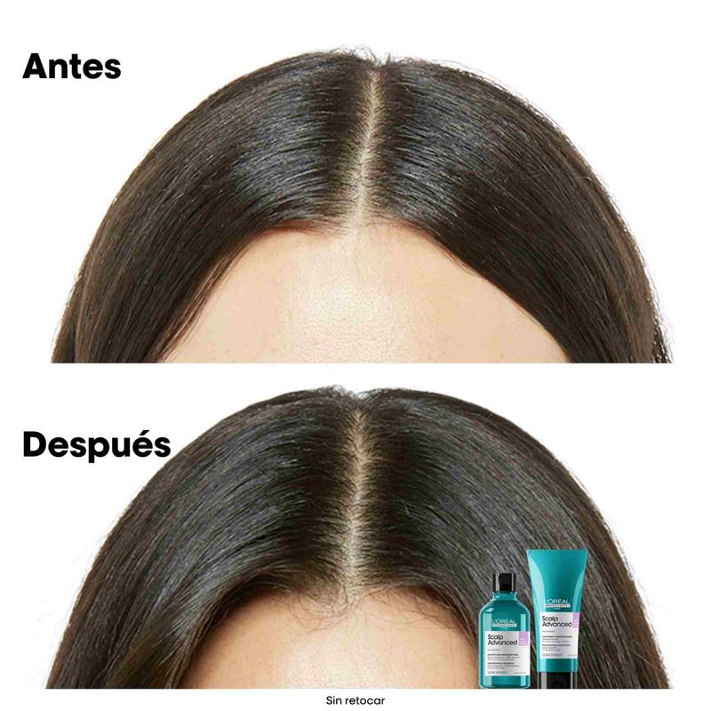 Shampoo Scalp Advanced Anti-Discomfort  Loreal x 300mL